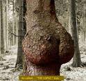 fesse